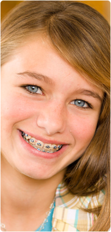 Right Age for Braces